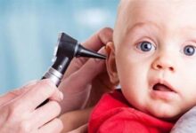 از هر ۱۰۰۰ تولد ۲ نوزاد به کم‌شنوایی و ناشنوایی مبتلا است